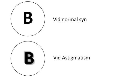 astigmatism-dk